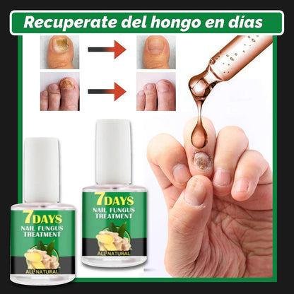 Compra 1 y llévate 2- Nailpro™ -  secreto para unas uñas que crecen más fuertes y sanas