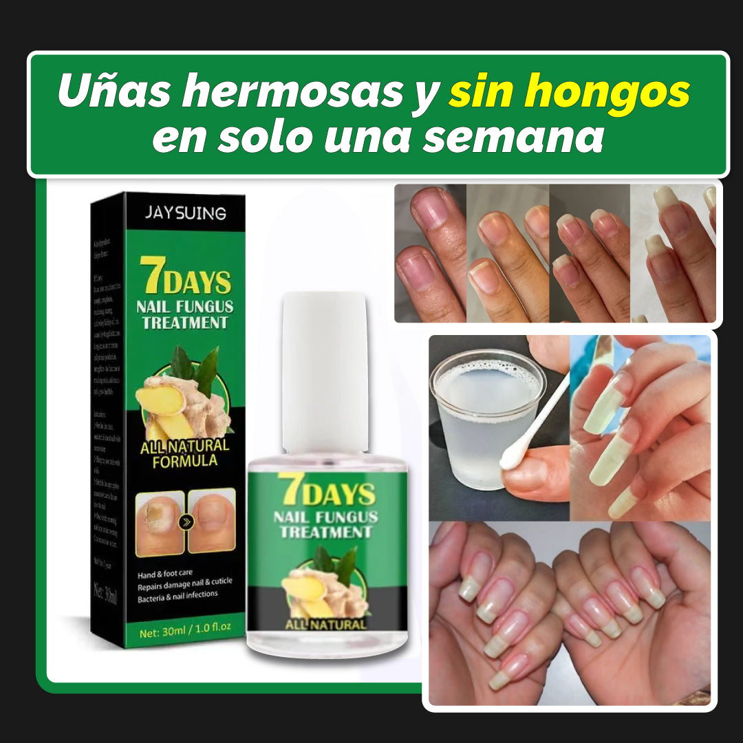 Compra 1 y llévate 2- Nailpro™ -  secreto para unas uñas que crecen más fuertes y sanas